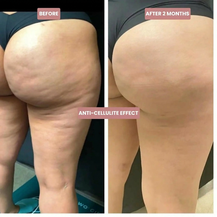 3D Legging – Redefine your silhouette effortlessly
